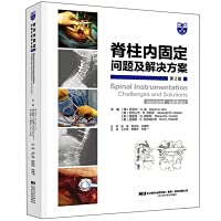 Spinal fixation (2nd edition)(Chinese Edition)