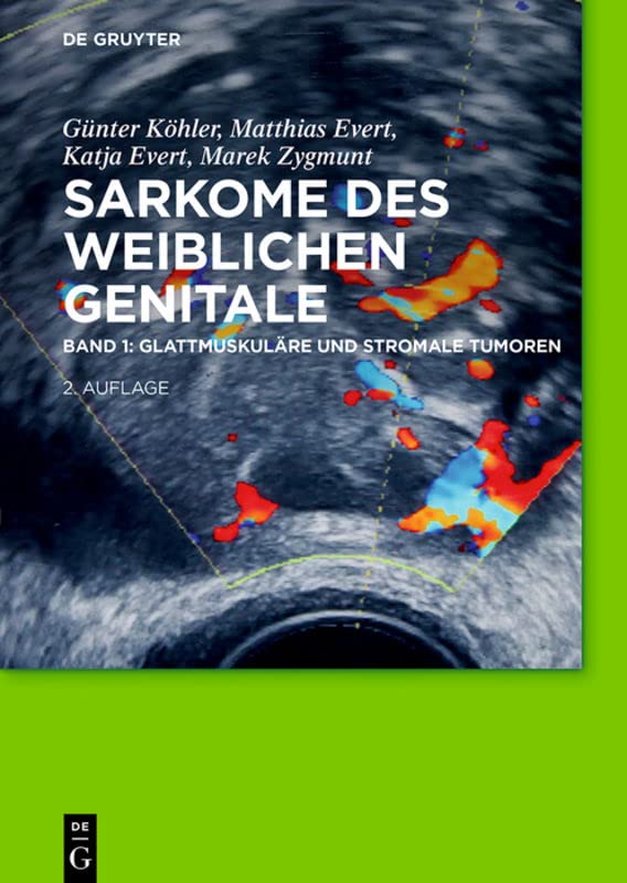 Glattmuskuläre und stromale Tumoren (German Edition)