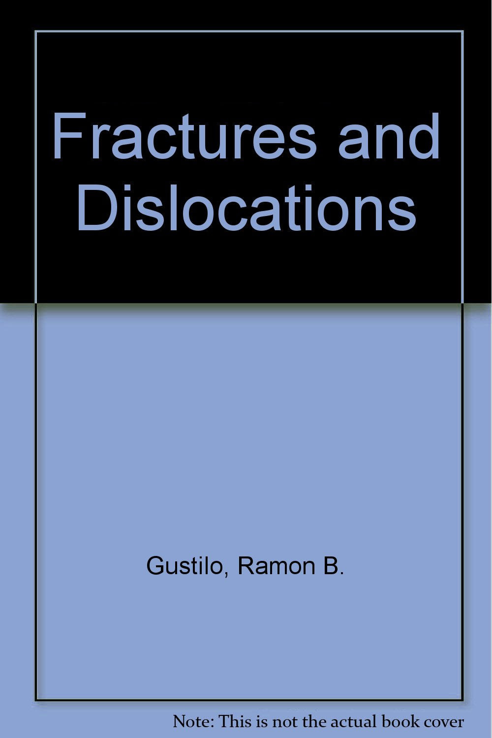 Fractures and Dislocations