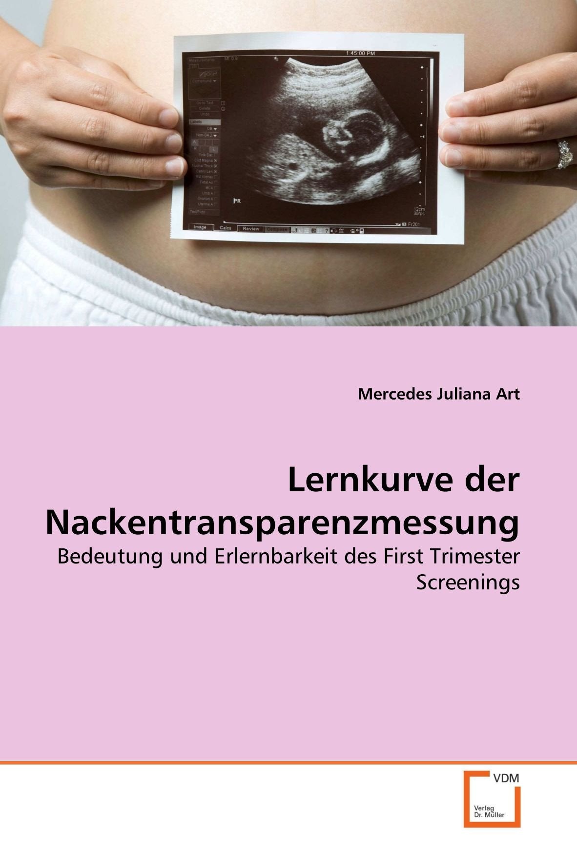 Lernkurve der Nackentransparenzmessung: Bedeutung und Erlernbarkeit des First Trimester Screenings (German Edition)