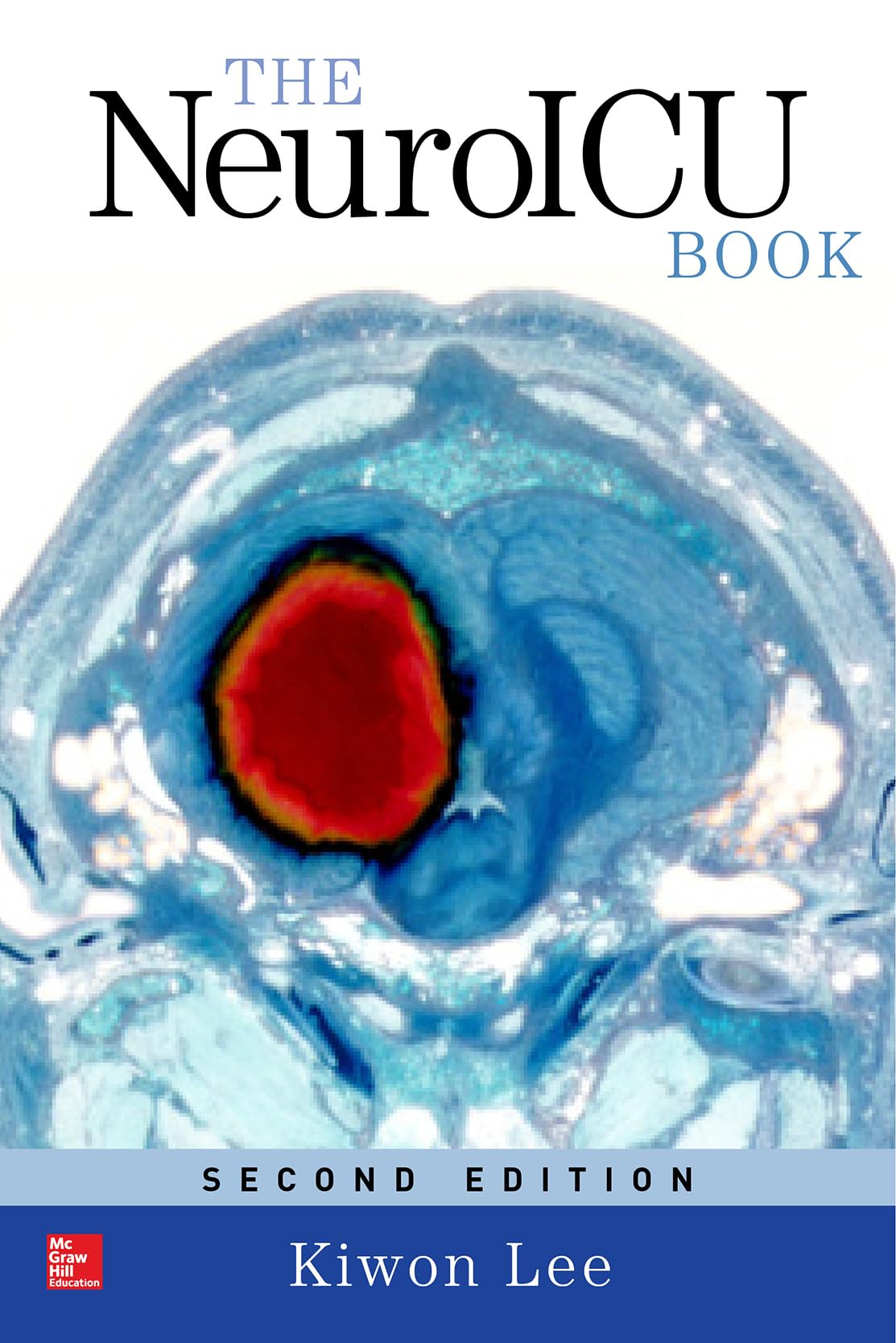 The NeuroICU Book, Second Edition
