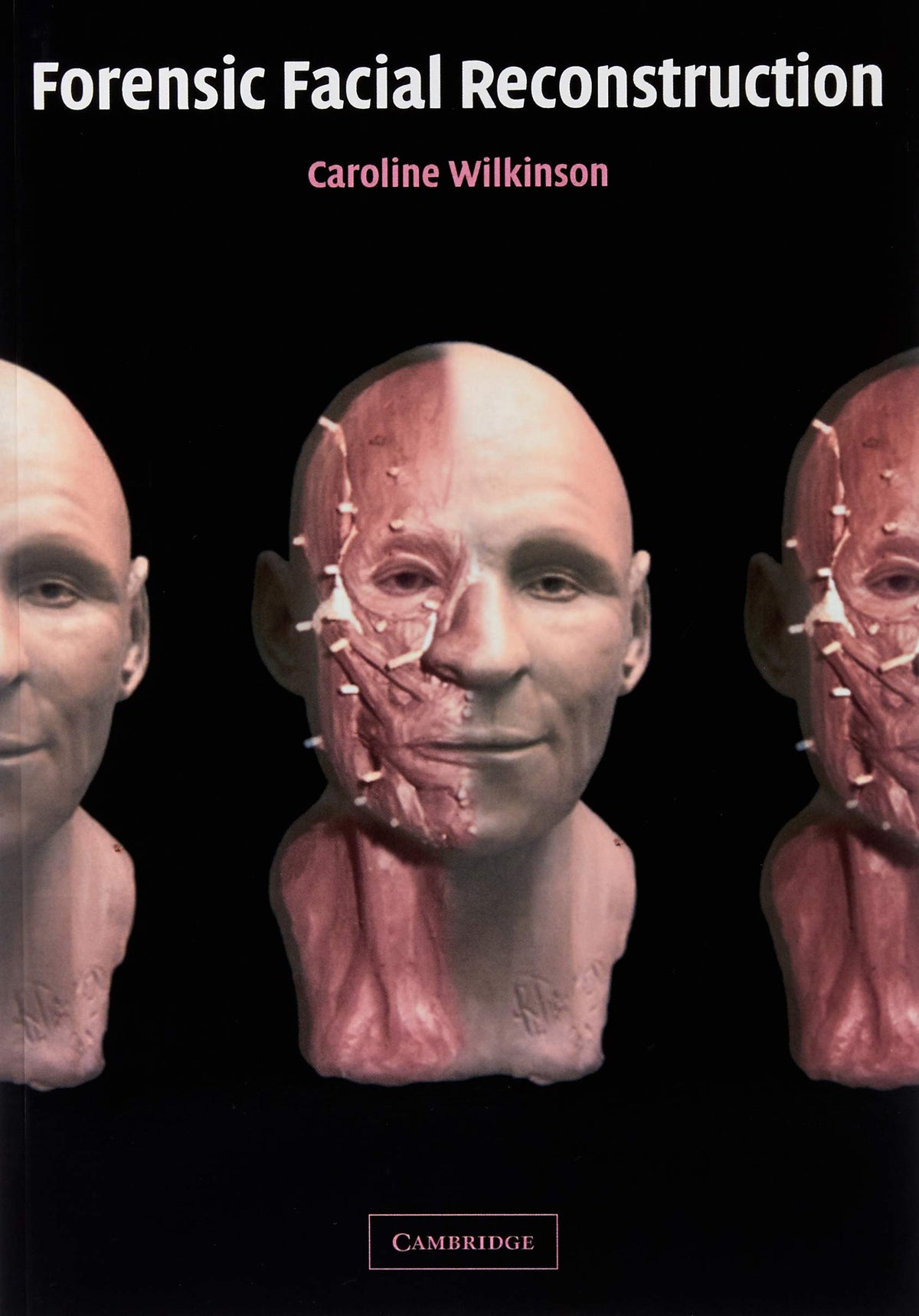 Forensic Facial Reconstruction (Volume 0)