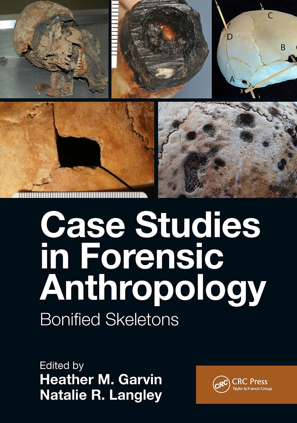 Case Studies in Forensic Anthropology: Bonified Skeletons