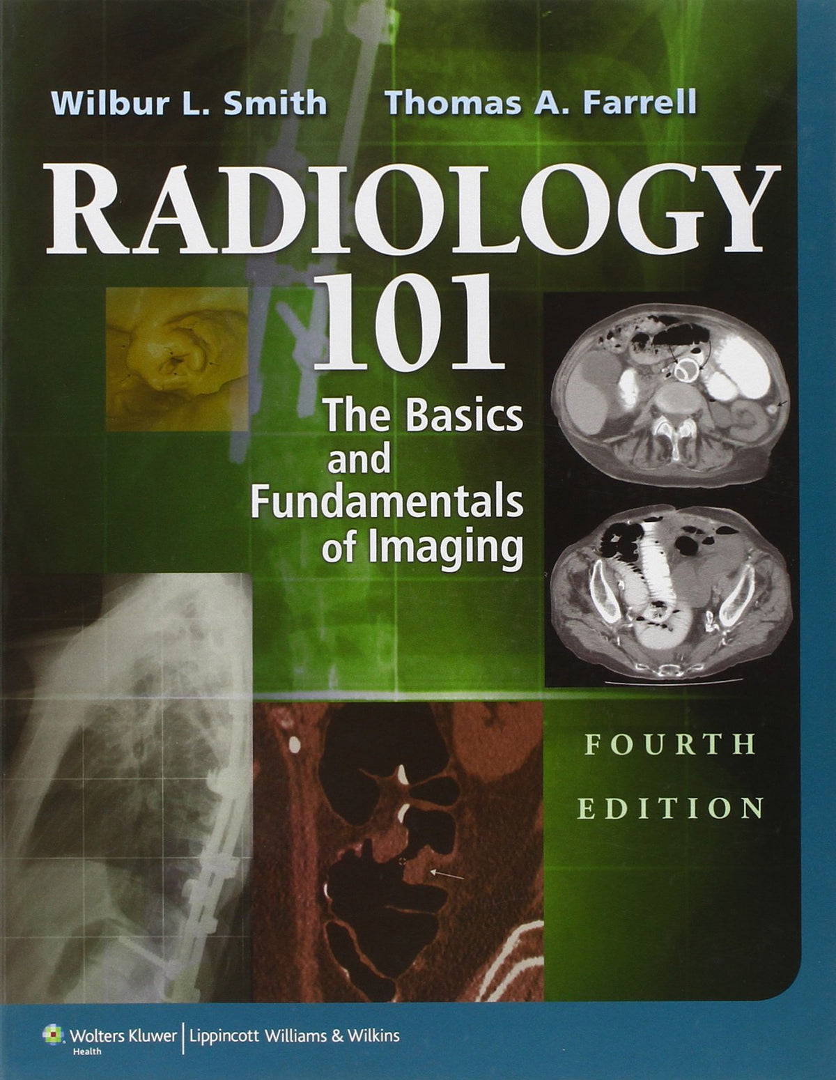 Radiology 101: The Basics & Fundamentals of Imaging
