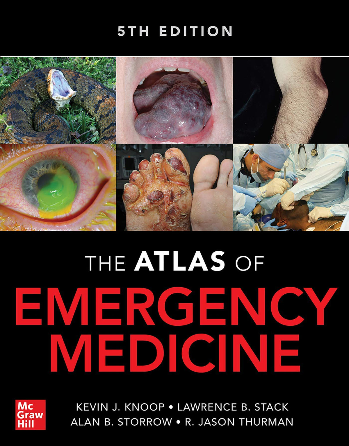 Atlas of Emergency Medicine, Fifth Edition