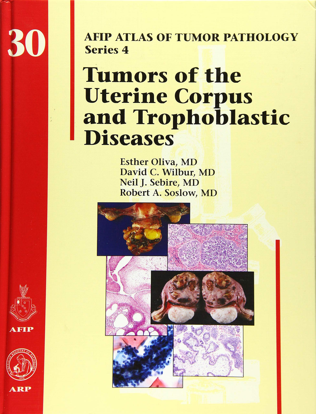 Tumors of the Uterine Corpus and Gestational Trophoblastic Diseases (AFIP Atlas of Tumor Pathology, Series 4)