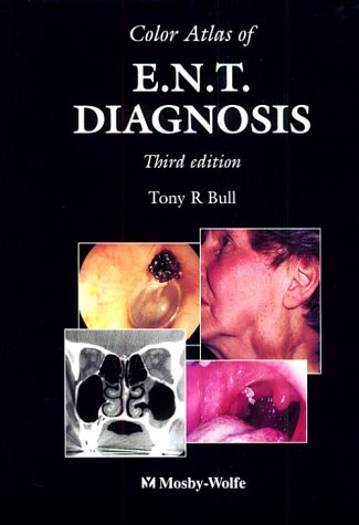 Color Atlas of Ent Diagnosis