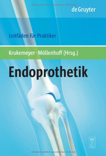 Endoprothetik / Endoprosthetics: Leitfaden Fur Praktiker (German Edition)
