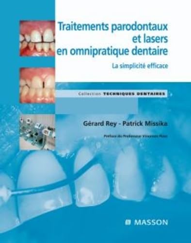 Traitements parodontaux et lasers en omnipratique dentaire: La simplicité efficace
