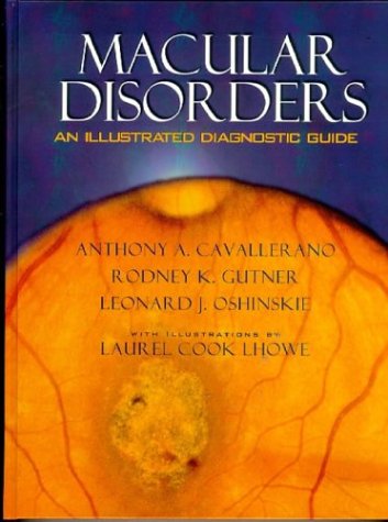 Macular Disorders: An Illustrated Diagnostic Guide