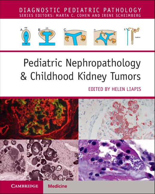 Pediatric Nephropathology & Childhood Kidney Tumors with Online Resource (Diagnostic Pediatric Pathology)
