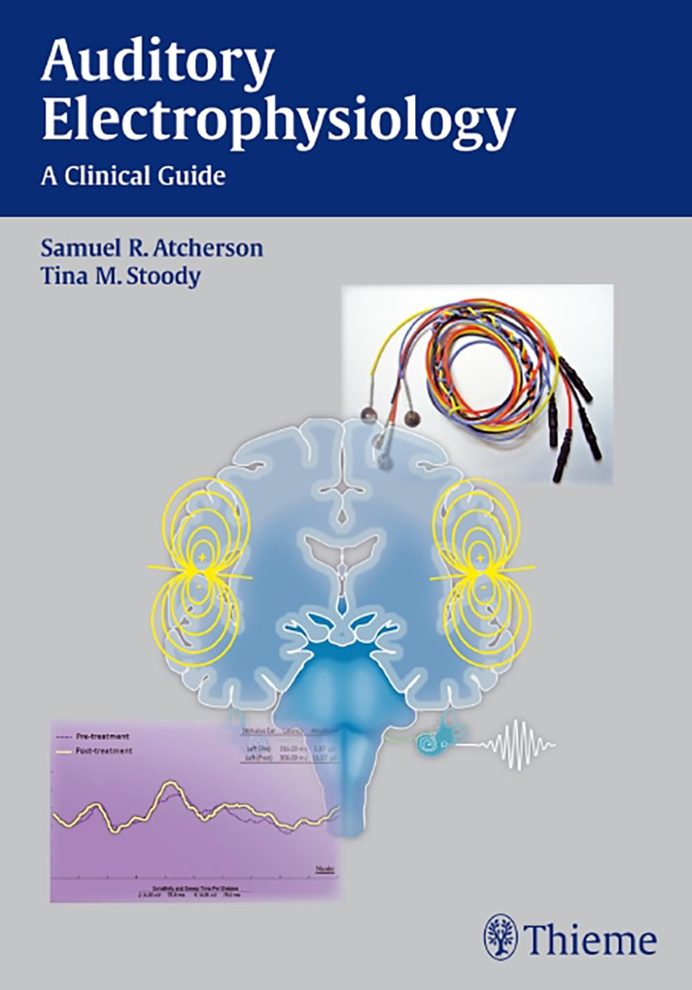 Auditory Electrophysiology: A Clinical Guide