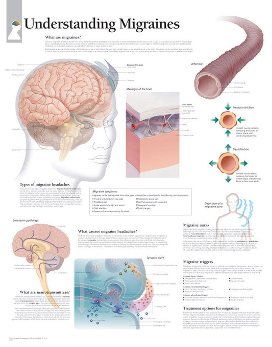 Understanding Migraines chart: Laminated Wall Chart