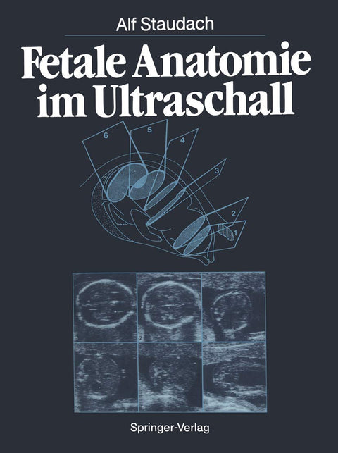 Fetale Anatomie im Ultraschall (German Edition)