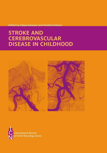 Stroke and Cerebrovascular Disease in Childhood (International Review of Child Neurology)