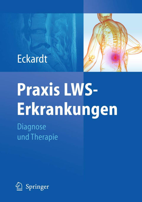 Praxis LWS-Erkrankungen: Diagnose und Therapie (German Edition)
