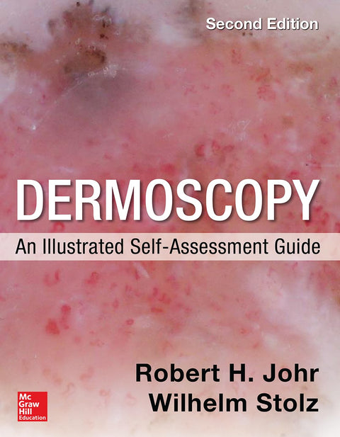 Dermoscopy: An Illustrated Self-Assessment Guide, 2/e