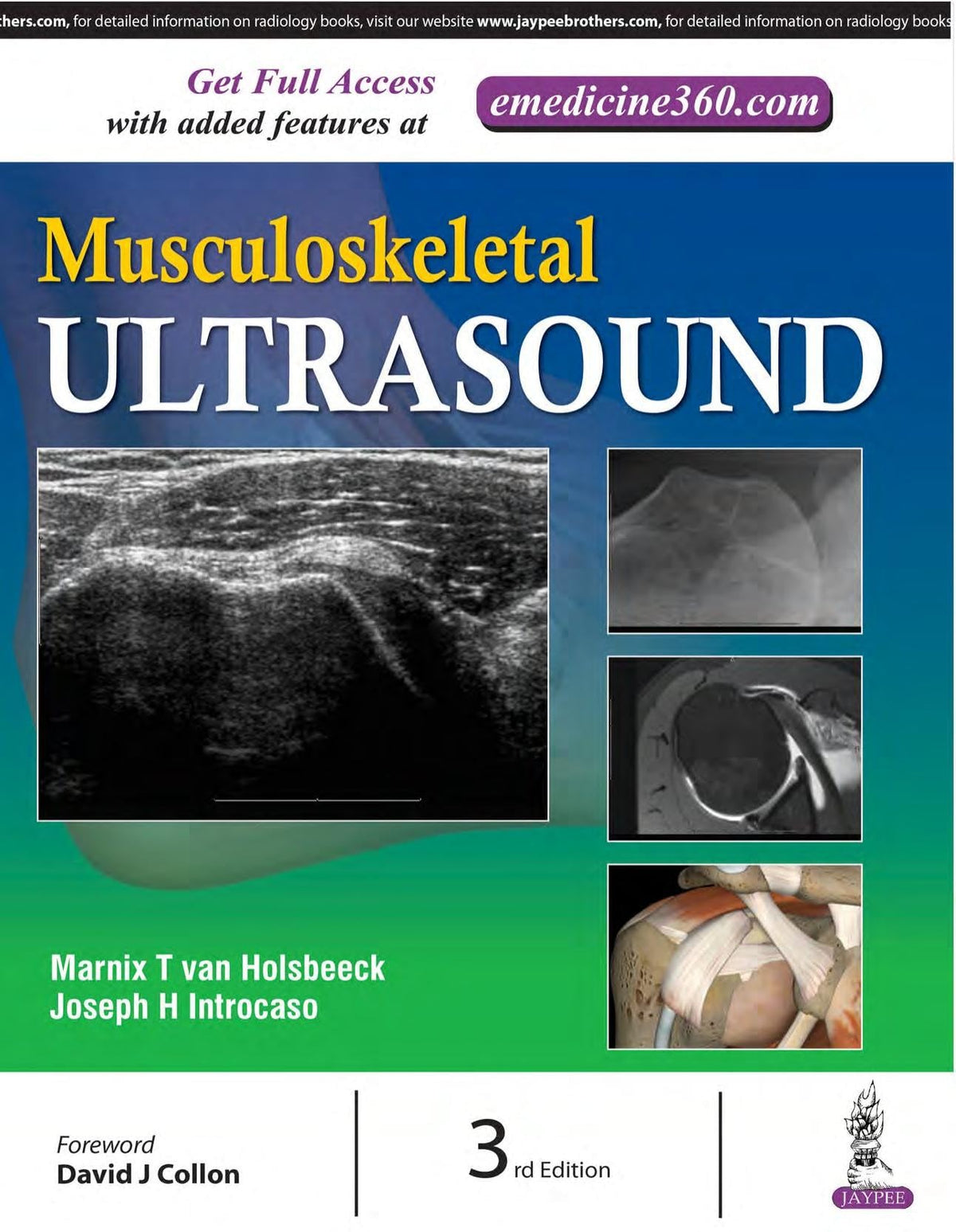 Musculoskeletal Ultrasound