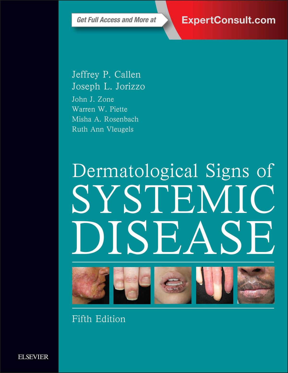 Dermatological Signs of Systemic Disease: Expert Consult - Online and Print