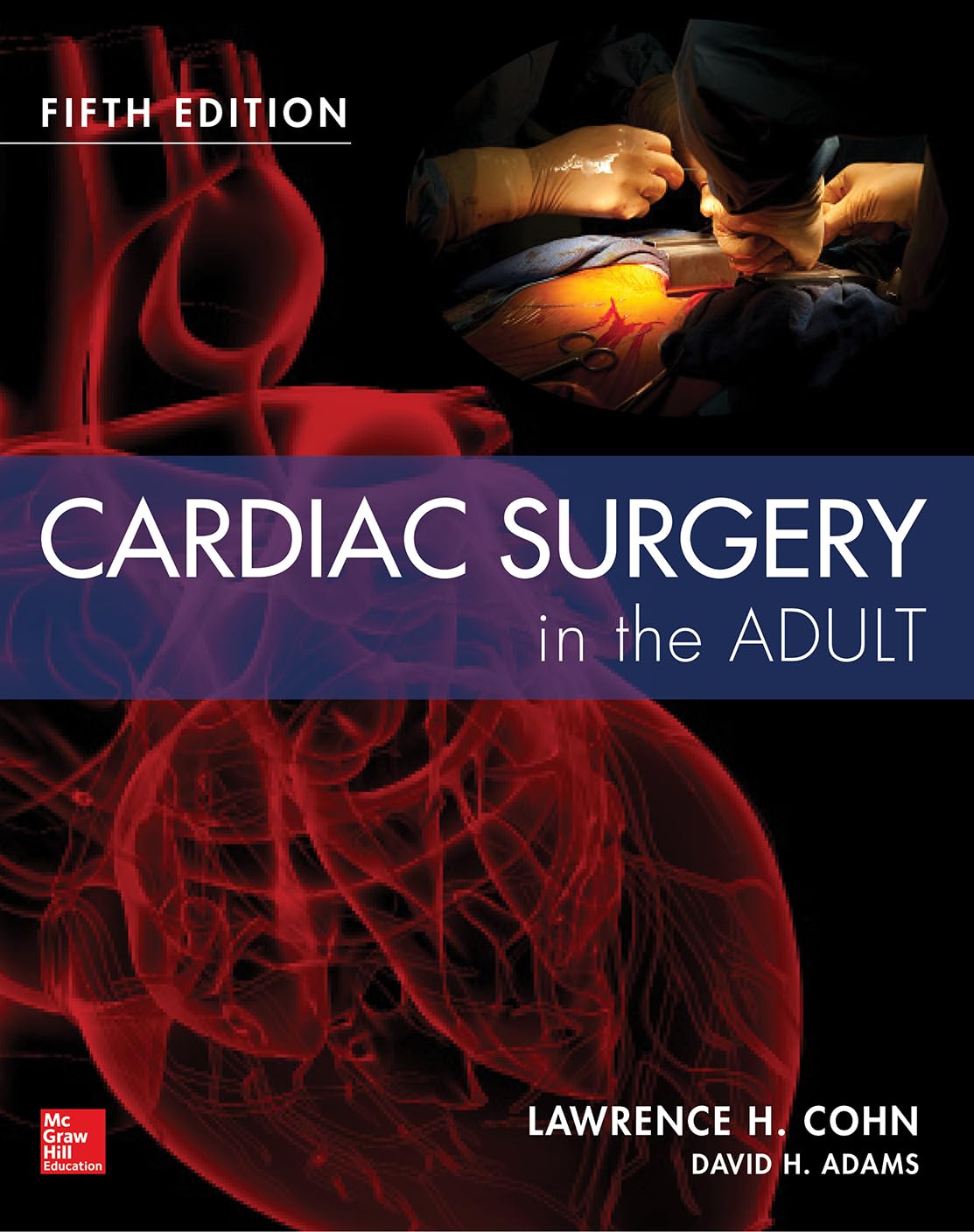 Cardiac Surgery in the Adult, Fifth Edition