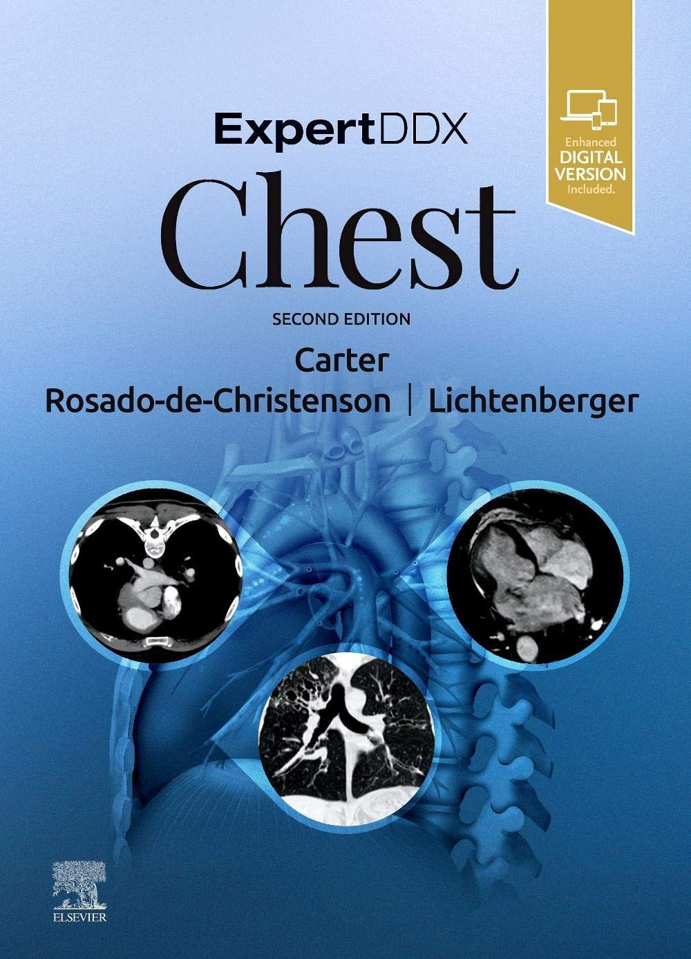 ExpertDDx: Chest