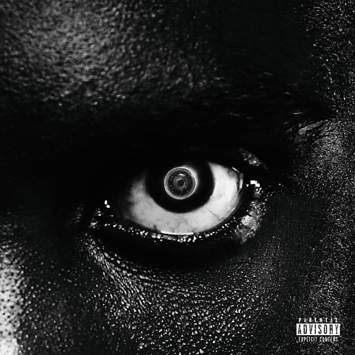 Lithopedion