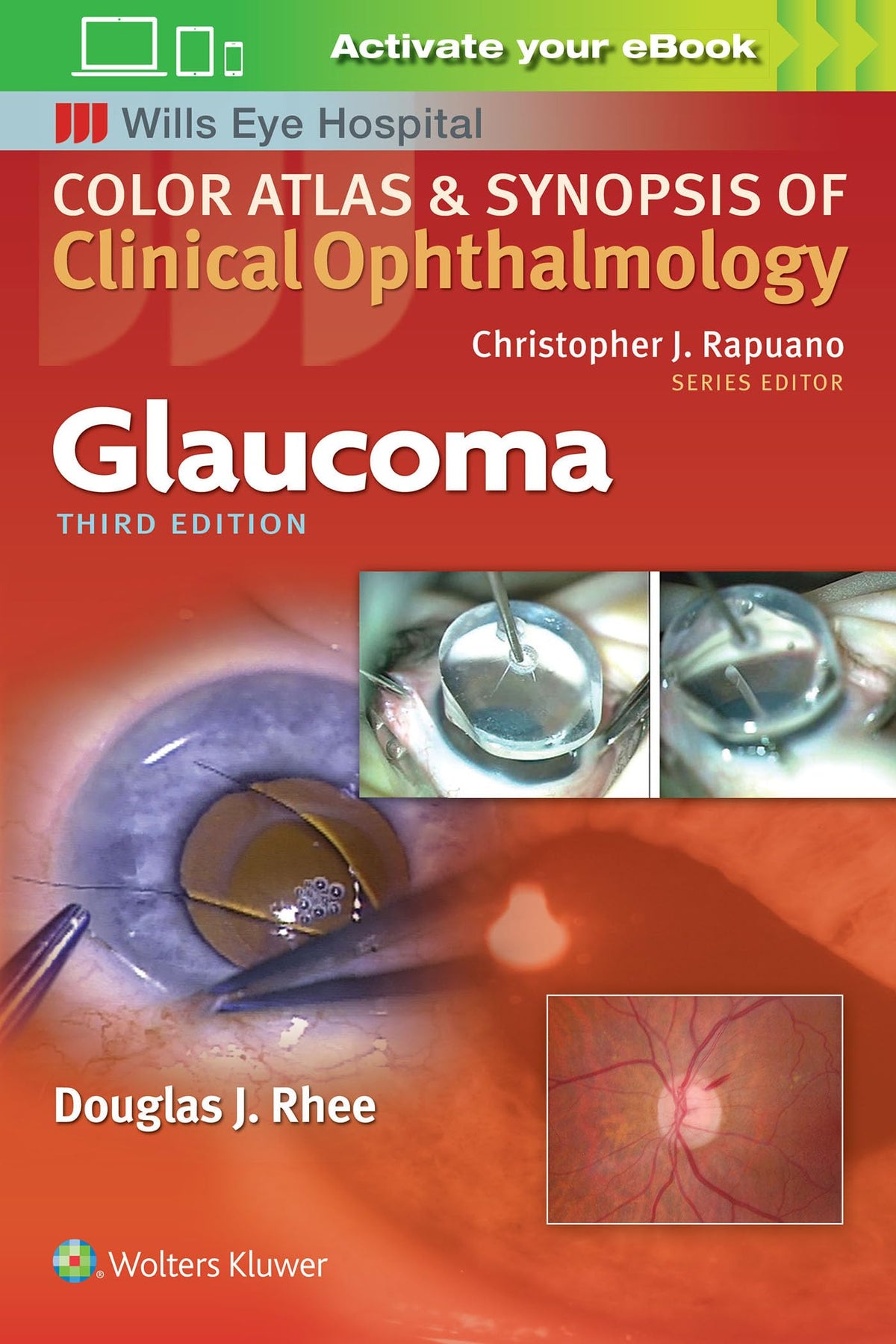 Glaucoma (Color Atlas and Synopsis of Clinical Ophthalmology)