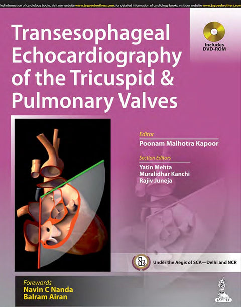 Transesophageal Echocardiography of the Tricuspid and Pulmonary Valves