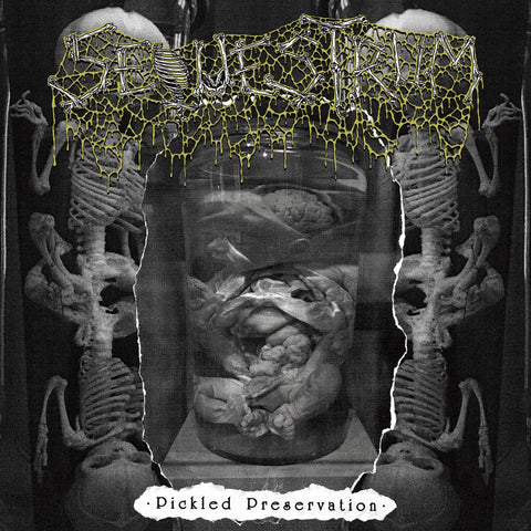 Pickled Preservation