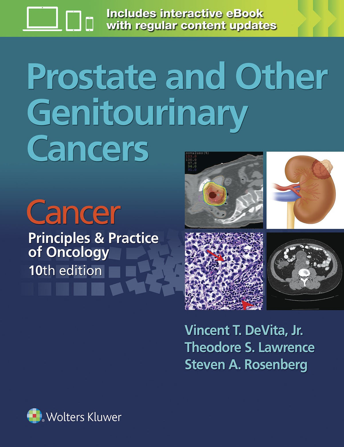 Prostate and Other Genitourinary Cancers: From Cancer: Principles & Practice of Oncology, 10th edition