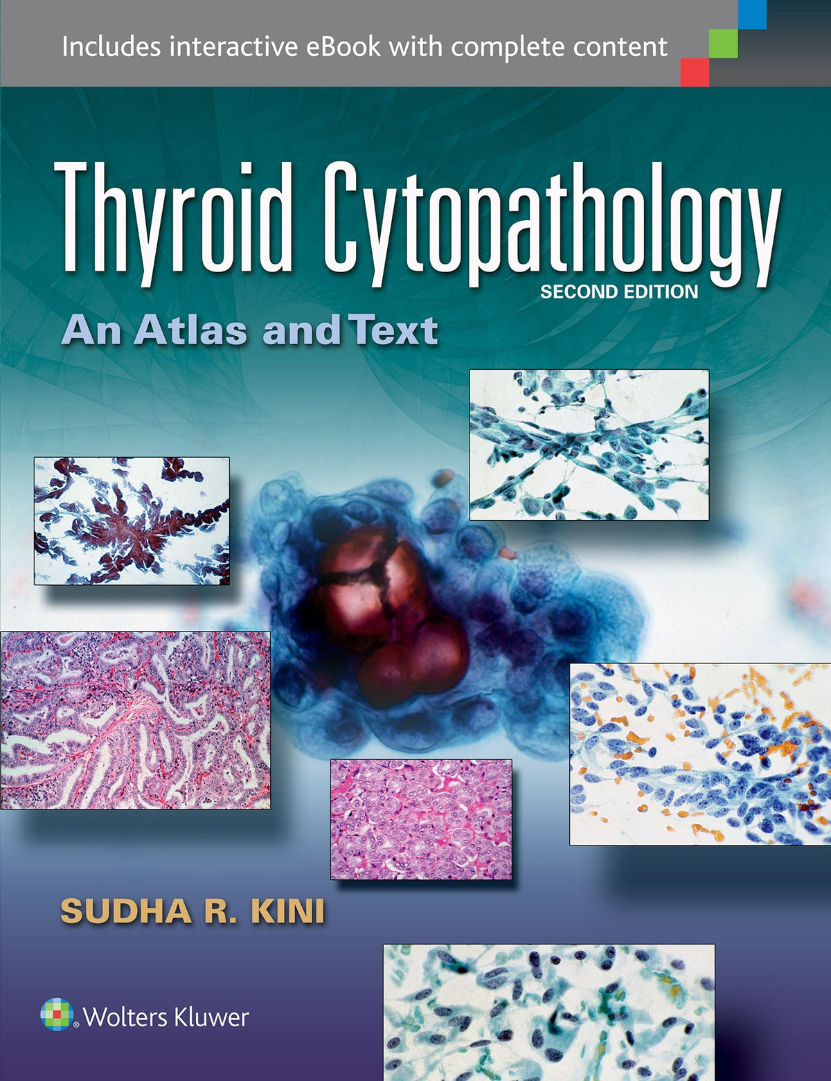 Thyroid Cytopathology: An Atlas and Text