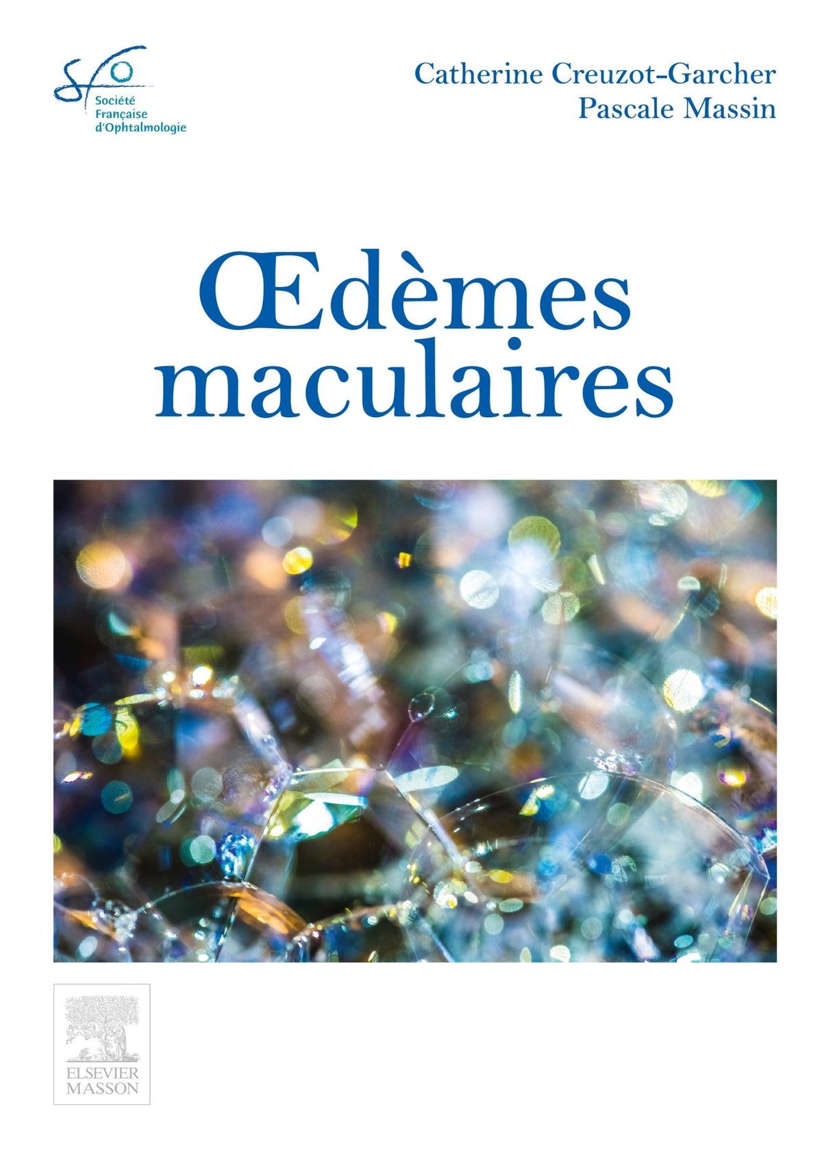 Oedèmes Maculaires: Rapport Sfo (French Edition)
