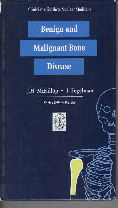 Clinician's Guide to Nuclear Medicine: Benign and Malignant Bone Disease